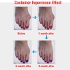 1 Pair Silicone Foot Care Hallux Valgus Corrector