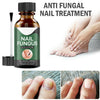 Anti Fungal Nail Treatment Nail Finger Toe Fungus Onychomycosis Remover