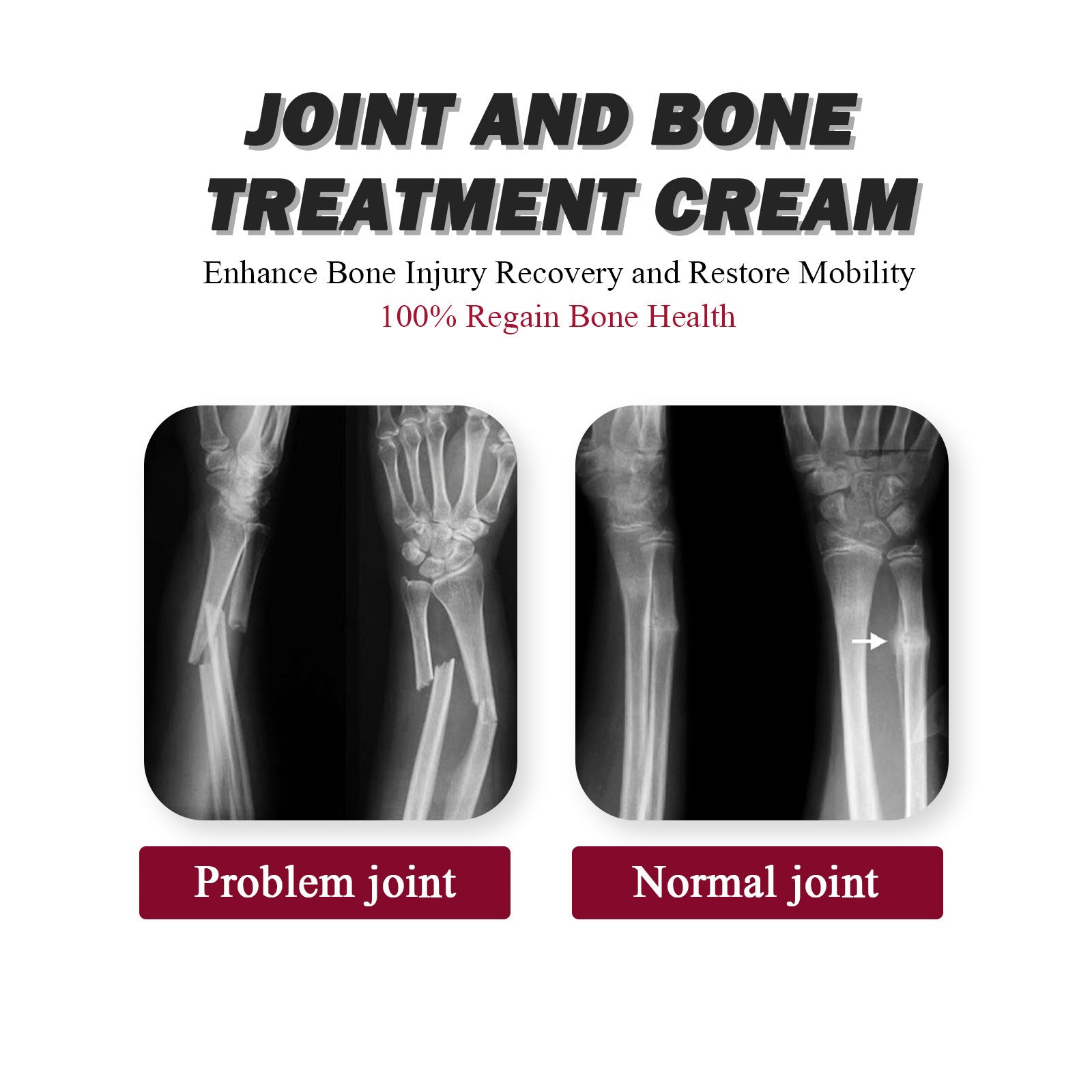 Protein Cream Soothes Joint Bone Soreness, Deformation, Correction And Repair