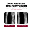 Protein Cream Soothes Joint Bone Soreness, Deformation, Correction And Repair