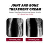 Protein Cream Soothes Joint Bone Soreness, Deformation, Correction And Repair