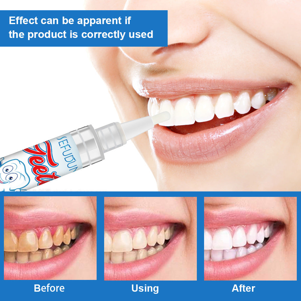 Bright White Teeth Pen Remove Smoke Stains Yellow Teeth Cleaning Teeth