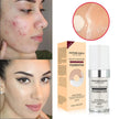 Concealing Foundation Temperature Change Skin Color