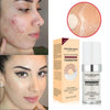 Concealing Foundation Temperature Change Skin Color