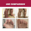 Protein Cream Soothes Joint Bone Soreness, Deformation, Correction And Repair