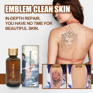 Tattoo Cleaning Agent Solution To Dilute Embroidery Pattern