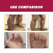 Protein Cream Soothes Joint Bone Soreness, Deformation, Correction And Repair