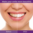 Teeth Cleaning Mousse Anti-moth Cleaning Yellow Teeth Tartar Breath Fresh Brightening White Beautiful Tooth Toothpaste