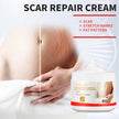 Pregnant Women Acne Scar Repair Cream