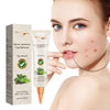 Skin Cleansing Black Mole Wart Ointment Hand And Foot Face Armpit Flesh Bump Neck Care Cream