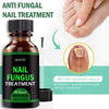 ANTI FUNGAL TREATMENT EXTRA STRENGTH TOENAIL FUNGUS ATHLETES FOOT FUNGI NAIL